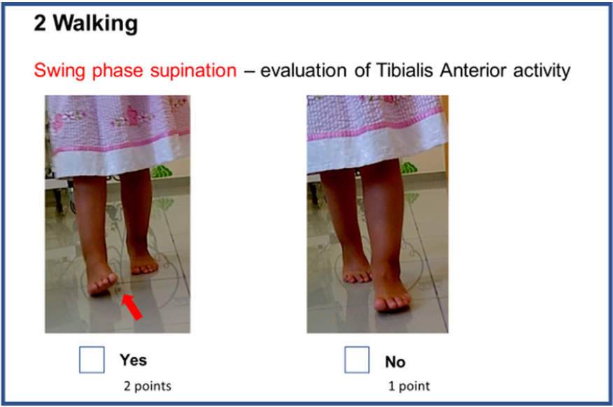 Swing Phase Supination - one of many photographic examples in this paper