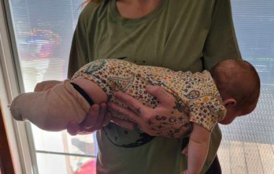 Holding Baby with Clubfoot Casts Prone from the Front